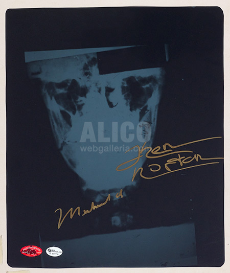 Muhammad Ali/Ken Norton I Broken Jaw X-Ray